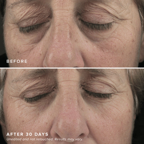 Brightening Eye Masks